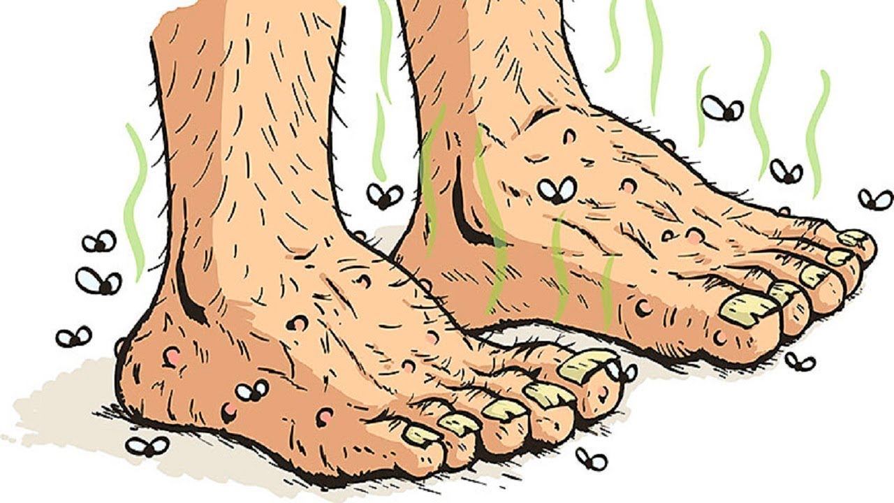 14 cách khử mùi hôi chân hiệu quả - Vĩnh biệt đôi bàn chân bốc mùi
